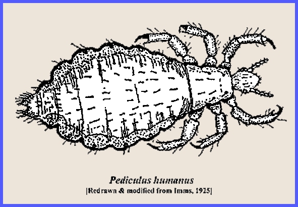 pediculosis corpus